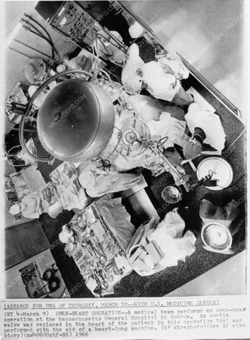 cool 1966 news photo open heart surgery medical technology 1174-22