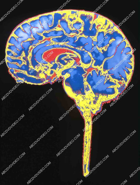 Brain Piclab cool computer enhanced brain pic Learning Channel documentary TV Under ...